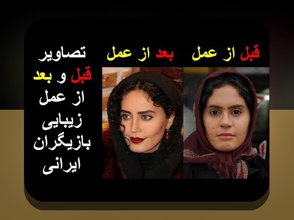 رازهای جذاب عکس قدیمی زیبا بروفه و تأثیر آن در سایت شرط بندی